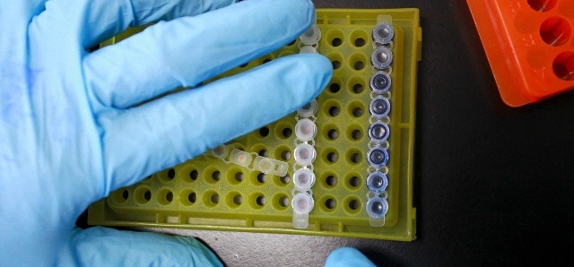 Vírus HIV