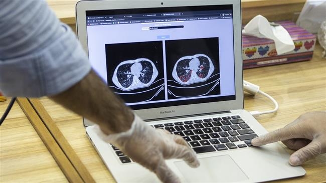 Tecnologia do Irã no combate ao coronavírus