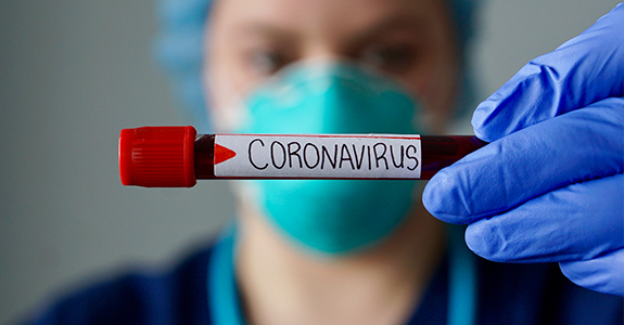Coronavirus - fechamento do comércio
