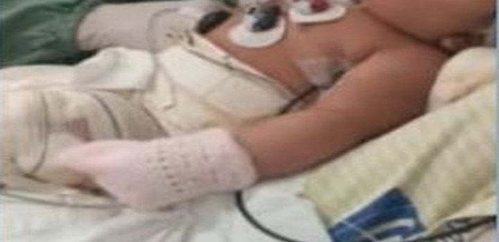 Juliana Duarte Anastácio, de 6 meses, teve 37% do corpo queimado no Hospital Municipal Getúlio Vargas FilhO