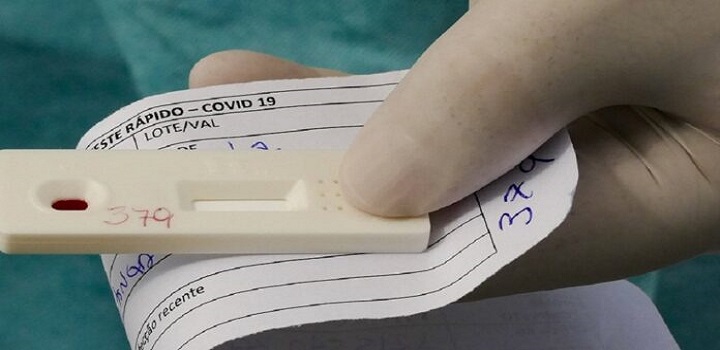 Estabelecimentos fechados em Macaé. testes de covid-19