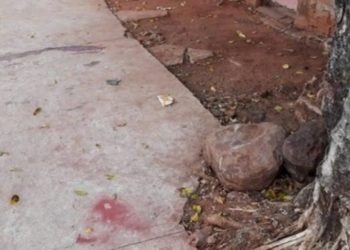 Morre Criança atacada por pitbull em Campos