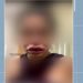 dentista de Campos dos Goytacazes, no Norte Fluminense, está sendo acusada por pacientes de deformar rostos após procedimentos de harmonização facial