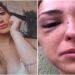 Gabrilea Castelato agredida pelo namorado