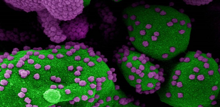 Covid-febre viral