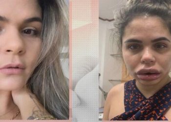 De acordo com testemunhas, Giselle tem um grande poder de convencimento e conseguia induzir as pessoas a realizarem mais procedimentos do que o necessário