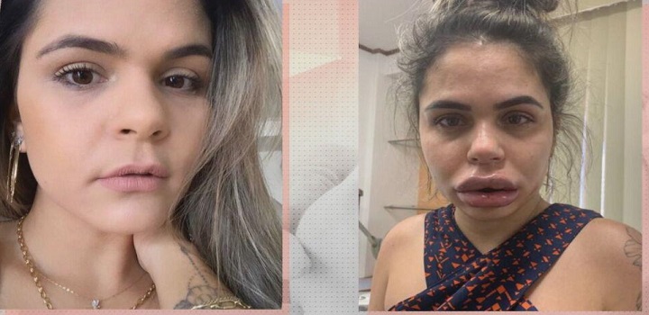 De acordo com testemunhas, Giselle tem um grande poder de convencimento e conseguia induzir as pessoas a realizarem mais procedimentos do que o necessário