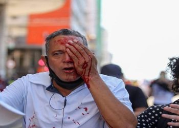 PM atira e homem perde o olho em RRecife