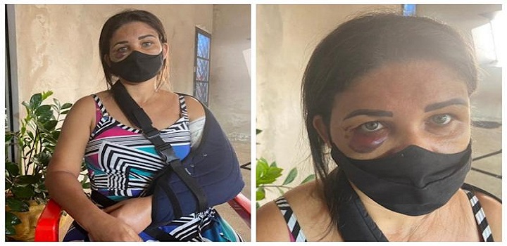 Adriana Araújo da Silva, funcionária de uma padaria em Palmares Paulista, em São Paulo, foi agredida por um cliente após pedir para que o homem usasse máscara
