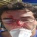 advogada envolvida na confusão disse que o tumulto teve início depois que policiais tentaram dar prioridade a uma mulher que estava no final da fila para a retirada de uma bicicleta de aplicativo