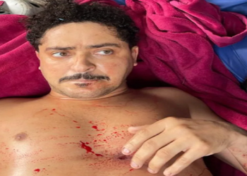 miliciano chegou a ser baleado e foi socorrido pelos policiais, porém não resistiu