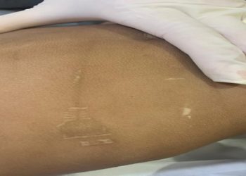 casal foi preso, na sexta-feira (23), suspeito de torturar e matar o filho de 1 ano
