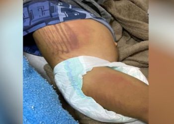 Mãe e padrasto são presos após agredirem crianças no DF