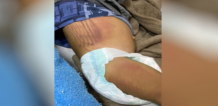 Mãe e padrasto são presos após agredirem crianças no DF