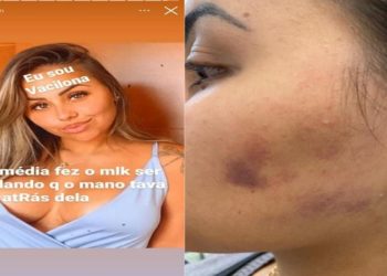Maithê Fernandes da Costa, ifluencer sofre agressoes do marido