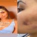Maithê Fernandes da Costa, ifluencer sofre agressoes do marido