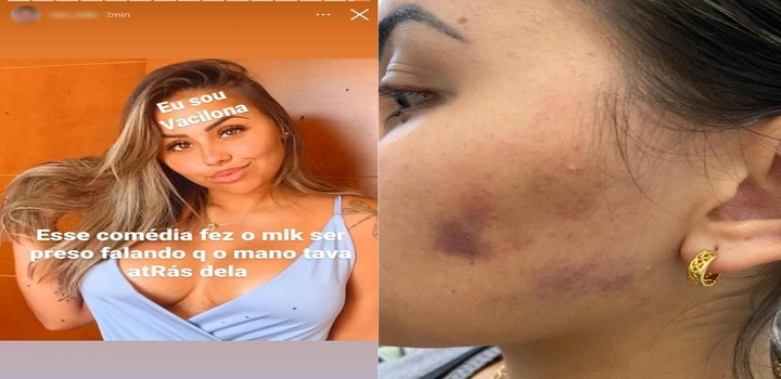 Maithê Fernandes da Costa, ifluencer sofre agressoes do marido