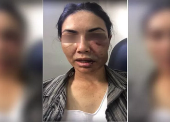 Mulher de 40 anos não sabe nadar e ficou boiando na água até ladrões irem embora