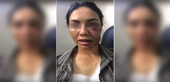 Mulher de 40 anos não sabe nadar e ficou boiando na água até ladrões irem embora