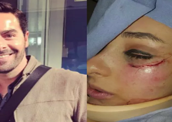 Ator agride atriz mexicana após acusação de agressao