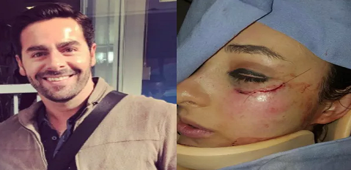 Ator agride atriz mexicana após acusação de agressao