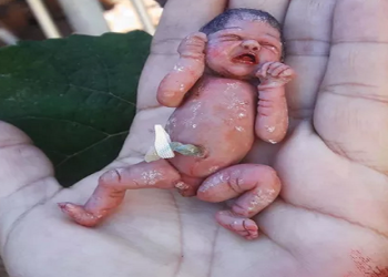 Segundo Fabiana Santos dos Reis, de Goiânia, quase metade dos pedidos vêm de pais de bebês prematuros que não sobreviveram. "Às vezes, é a única lembrança", conta