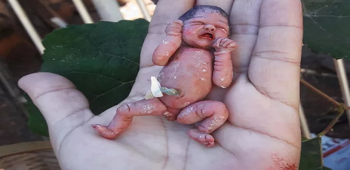Segundo Fabiana Santos dos Reis, de Goiânia, quase metade dos pedidos vêm de pais de bebês prematuros que não sobreviveram. "Às vezes, é a única lembrança", conta