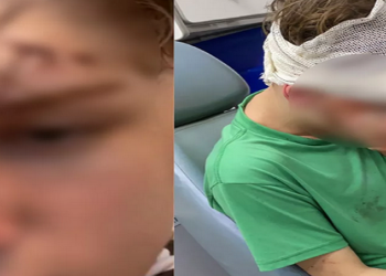 Vítimas tiveram que ser encaminhadas ao hospital em Praia Grande e família busca por agressor