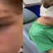 Vítimas tiveram que ser encaminhadas ao hospital em Praia Grande e família busca por agressor