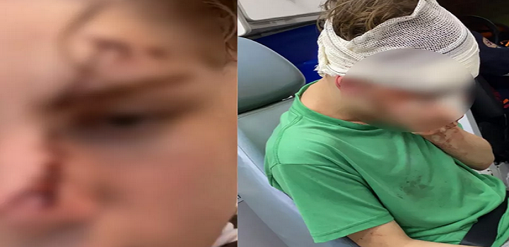 Vítimas tiveram que ser encaminhadas ao hospital em Praia Grande e família busca por agressor