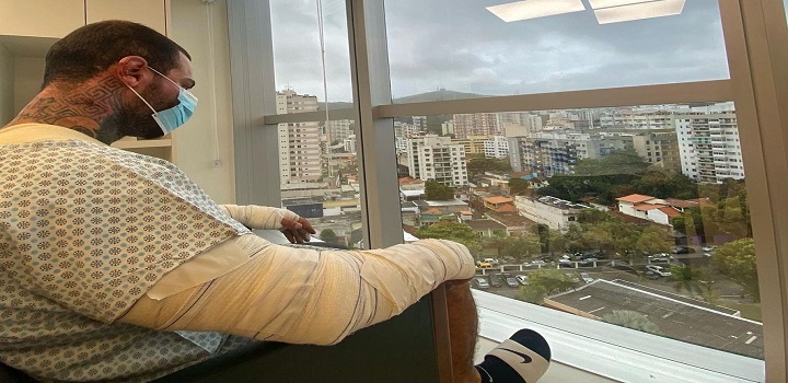 LEO STRONDA TEM CORPO QUEIMADO APÓS ACIDENTE COM BOTIJÃO DE GÁS