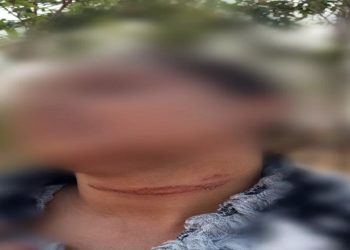 Vereador de serranópolis amarra mulher em árvore