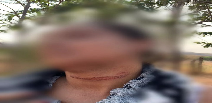 Vereador de serranópolis amarra mulher em árvore