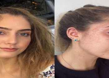 "Sentei a mão nela", diz estudante de medicina após espancar a ex-namorada. O agressor pagou R$ 5 mil de fiança e já está em liberdade