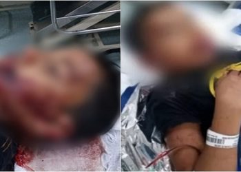 menino autista de 8 anos que desapareceu na noite do último domingo (14/11) foi encontrado dias depois desorientado e com marcas de agressão em Sorocaba