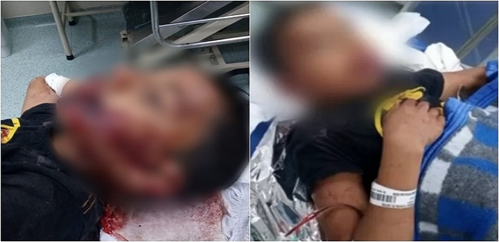 menino autista de 8 anos que desapareceu na noite do último domingo (14/11) foi encontrado dias depois desorientado e com marcas de agressão em Sorocaba