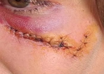 Imagem mostra quando homem a empurra e ela cai batendo as costas e cabeça no meio-fio, após discutirem, ele ainda dá um soco no rosto dela, a derrubando novamente. Agressão aconteceu em frente a bar de Nerópolis.