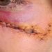 Imagem mostra quando homem a empurra e ela cai batendo as costas e cabeça no meio-fio, após discutirem, ele ainda dá um soco no rosto dela, a derrubando novamente. Agressão aconteceu em frente a bar de Nerópolis.