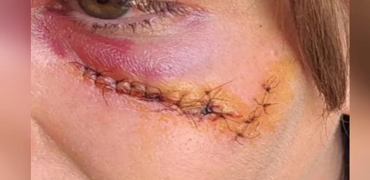 Imagem mostra quando homem a empurra e ela cai batendo as costas e cabeça no meio-fio, após discutirem, ele ainda dá um soco no rosto dela, a derrubando novamente. Agressão aconteceu em frente a bar de Nerópolis.