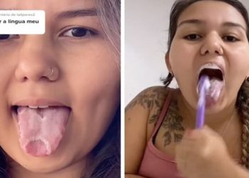 "Pesquise 'língua geográfica' antes de falar que não escovo minha língua". A capixaba Roberta Santos, 22 anos, deixa a frase no topo do seu perfil no TikTok. É uma tentativa para não ter que, mais uma vez, rebater comentários e conselhos não solicitados.