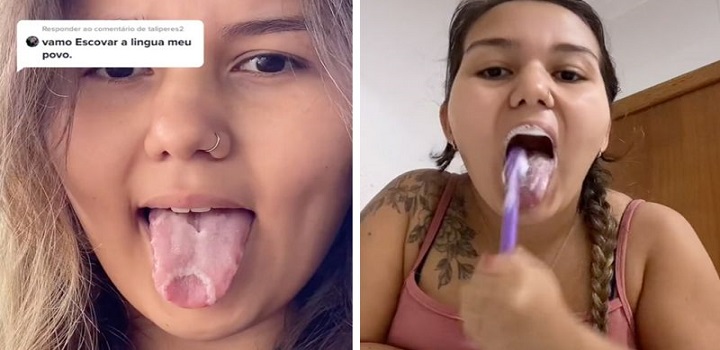 "Pesquise 'língua geográfica' antes de falar que não escovo minha língua". A capixaba Roberta Santos, 22 anos, deixa a frase no topo do seu perfil no TikTok. É uma tentativa para não ter que, mais uma vez, rebater comentários e conselhos não solicitados.