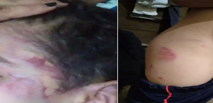 Um lutador de Muay Thai foi preso em Chapadão do Sul, no Mato Grosso do Sul, após espancar o enteado de apenas 5 anos de idade.