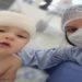 O pequeno Theo, 7 meses, teve sorte: apesar do afundamento no crânio, causado por uma queda da cama, ele passou por uma cirurgia, mas se recupera bem. Casos como esse tem aumentado, observa neurocirurgião paranaense. "É uma nova 'doença da pandemia'.