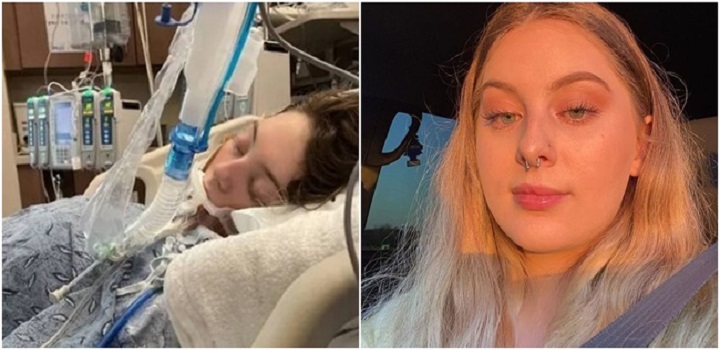 Aos 18 anos, jovem é intubada por complicações do uso do cigarro eletrônico. Médicos confirmaram que, em apenas 4 anos, os cigarros deterioram significativamente seus pulmões
