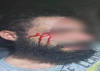 Médica foi condenada por mandar cortar pênis do ex-noivo em 2002 Após cumprir seis anos de prisão, ela é investigada por agredir e humilhar o atual marido