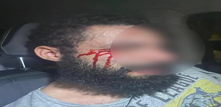 Médica foi condenada por mandar cortar pênis do ex-noivo em 2002 Após cumprir seis anos de prisão, ela é investigada por agredir e humilhar o atual marido