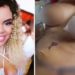 vendedora tem necrose após cirurgia plastica em Goiania