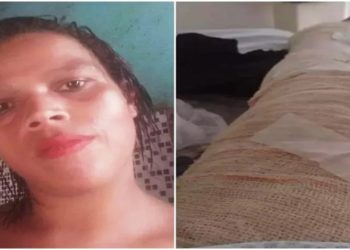 Jovem morrer após se queimar com álcool