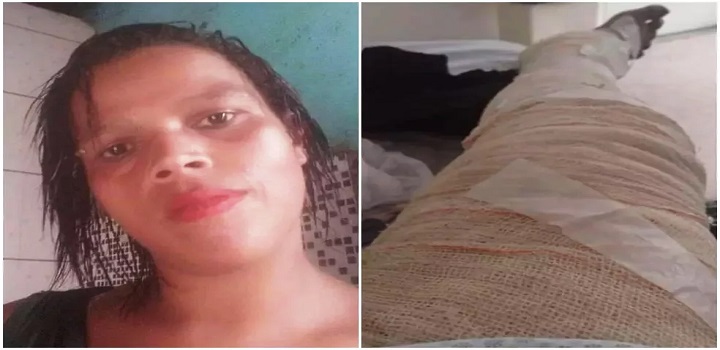 Jovem morrer após se queimar com álcool