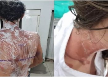 Cerca de 20 alunos apresentam queimaduras após trote realizado na UFPR